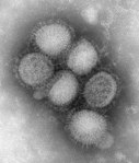 Virus de la gripe A H1N1
